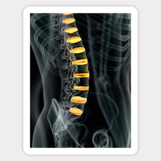 Human spinal intervertebral discs (F011/7098) Sticker